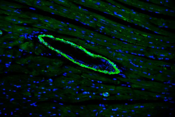 TAGLN/Transgelin Antibody