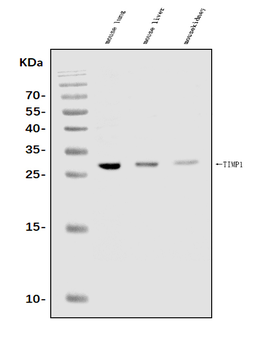 TIMP1 Antibody