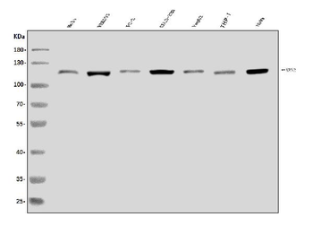 XRN2 Rabbit Polyclonal Antibody