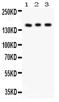 Insulin Receptor/INSR Rabbit Polyclonal Antibody