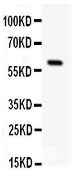Somatostatin Receptor 1/SSTR1 Rabbit Polyclonal Antibody