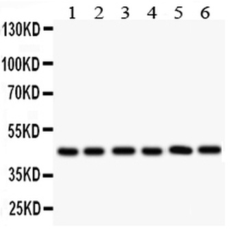 IL2RA Rabbit Polyclonal Antibody