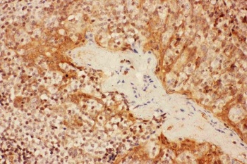 IL2RA Rabbit Polyclonal Antibody