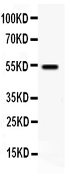 VIP Receptor 1/VIPR1 Rabbit Polyclonal Antibody