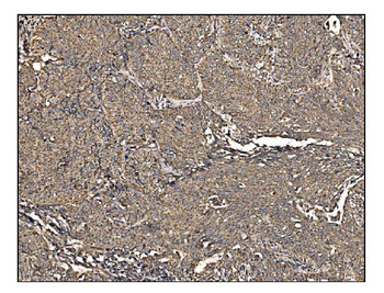 Arginine decarboxylase/AZIN2 Rabbit Polyclonal Antibody