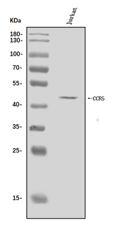 CCR5 Rabbit Polyclonal Antibody