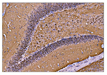 CAMKIV/Camk4 Antibody
