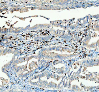 CTLA4 Rabbit Polyclonal Antibody