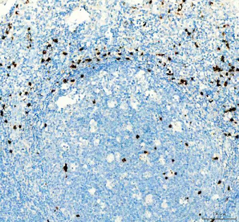 CTLA4 Rabbit Polyclonal Antibody