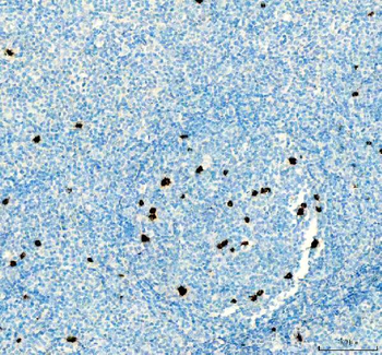 CTLA4 Rabbit Polyclonal Antibody