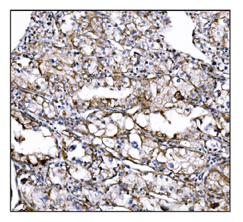 DLGAP1 Rabbit Polyclonal Antibody