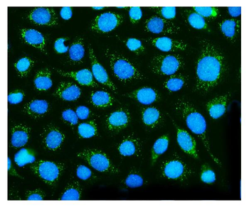 Dysferlin/DYSF Rabbit Polyclonal Antibody