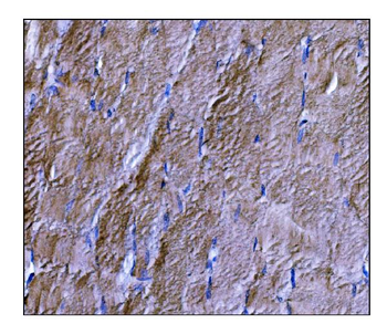 Dysferlin/DYSF Rabbit Polyclonal Antibody
