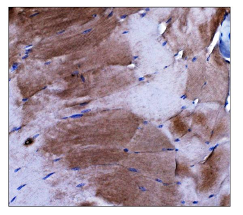 Dysferlin/DYSF Rabbit Polyclonal Antibody