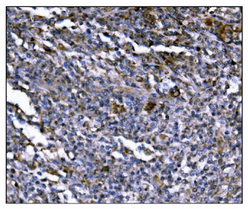 ERAP2 Rabbit Polyclonal Antibody