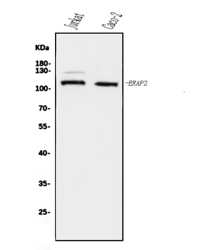 ERAP2 Rabbit Polyclonal Antibody
