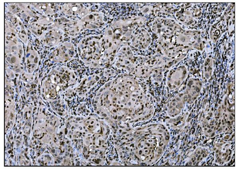 Fos B/FOSB Rabbit Polyclonal Antibody