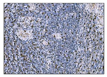 Fos B/FOSB Rabbit Polyclonal Antibody