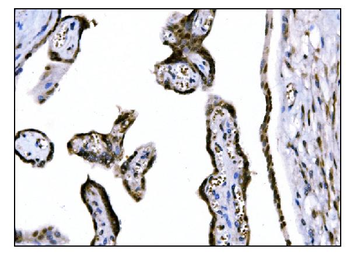 Fos B/FOSB Rabbit Polyclonal Antibody