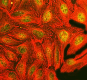 FTO Rabbit Polyclonal Antibody