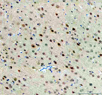 FTO Rabbit Polyclonal Antibody