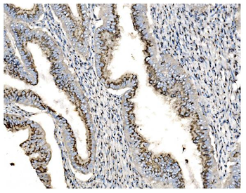 GOLPH2/GOLM1 Rabbit Polyclonal Antibody