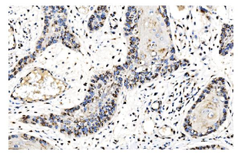 GOLPH2/GOLM1 Rabbit Polyclonal Antibody