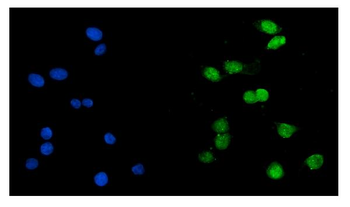 KAT1/HAT1 Rabbit Polyclonal Antibody