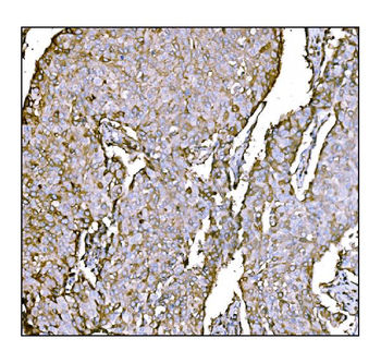 HCCS Antibody