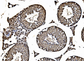 HDAC2 Rabbit Polyclonal Antibody