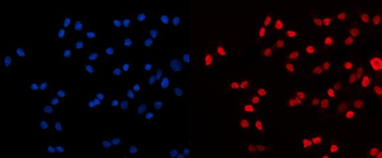 HDAC2 Rabbit Polyclonal Antibody