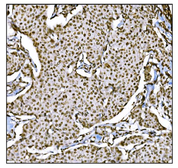 HDAC2 Rabbit Polyclonal Antibody