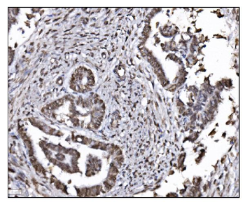 HDAC2 Rabbit Polyclonal Antibody