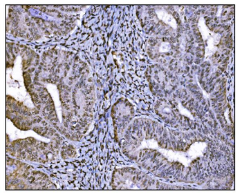 HDAC2 Rabbit Polyclonal Antibody