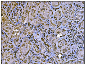 HDAC2 Rabbit Polyclonal Antibody