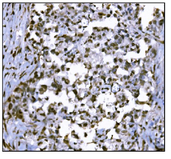 HDAC2 Rabbit Polyclonal Antibody