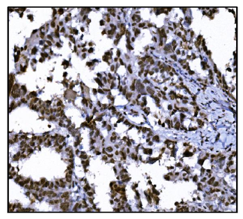 HDAC2 Rabbit Polyclonal Antibody