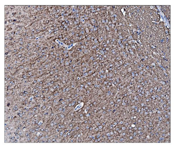 alpha Internexin/INA Rabbit Polyclonal Antibody