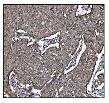 LRP1B Rabbit Polyclonal Antibody