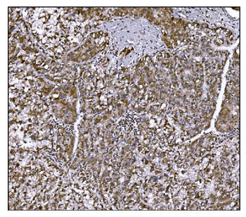 LRP1B Rabbit Polyclonal Antibody