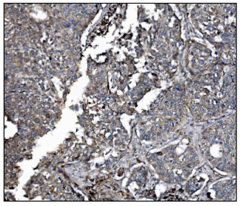 LRP1B Rabbit Polyclonal Antibody