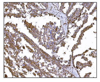 LRP1B Rabbit Polyclonal Antibody
