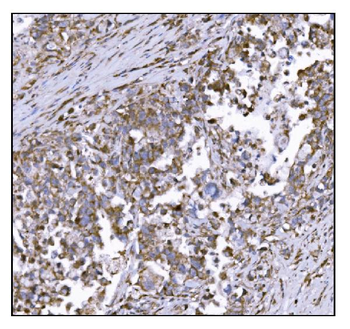 LRP1B Rabbit Polyclonal Antibody
