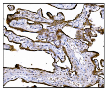 LRP1B Rabbit Polyclonal Antibody
