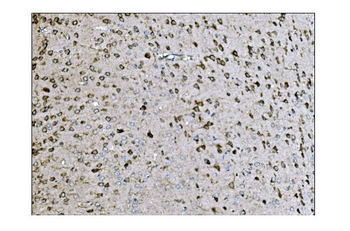 LRP1B Rabbit Polyclonal Antibody