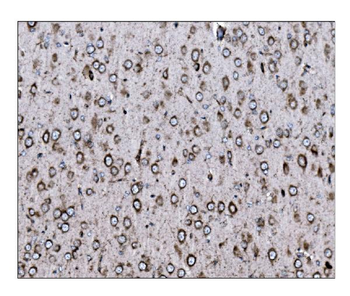 LRP1B Rabbit Polyclonal Antibody
