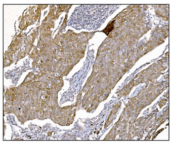 NDEL1 Rabbit Polyclonal Antibody