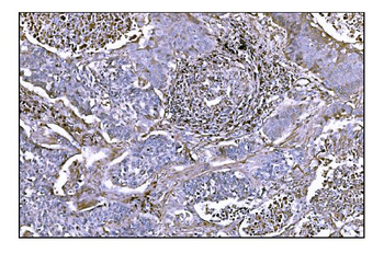 NDEL1 Rabbit Polyclonal Antibody