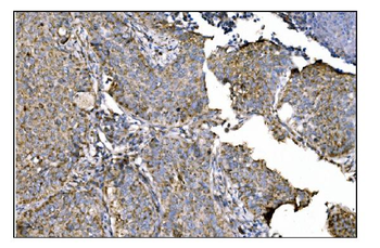 ornithine aminotransferase/OAT Rabbit Polyclonal Antibody