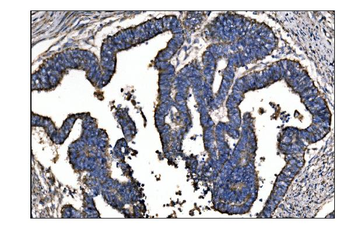 ornithine aminotransferase/OAT Rabbit Polyclonal Antibody